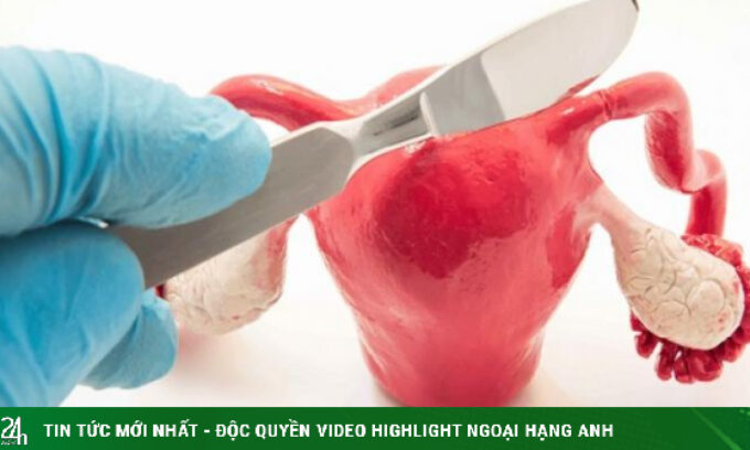 Những hành vi âm thầm phá hoại tử cung, phụ nữ nên biết để tránh xa