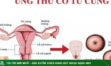 Độ tuổi nào phụ nữ cần tầm soát ung thư cổ tử cung?