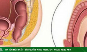 Bé trai 11 tuổi đã mắc ung thư tinh hoàn, chuyên gia cảnh báo dấu hiệu phát hiện sớm bệnh