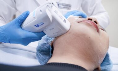 Công nghệ HIFU có thể xóa nếp nhăn, nọng cằm không?