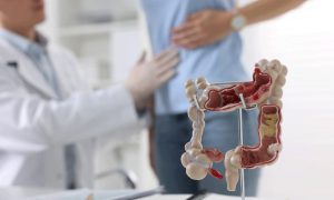 Phát hiện mắc ung thư đại tràng từ sắc mặt xấu