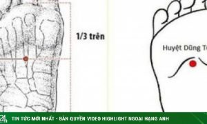 Bác sĩ y học cổ truyền khuyến cáo một số biện pháp phòng ngừa đột quỵ vào mùa lạnh